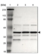 Lane 1: Marker [kDa] 219, 112, 85, 49, 32, 25, 18_br/_Lane 2: Human cell line RT-4_br/_Lane 3: Human cell line EFO-21_br/_Lane 4: Human cell line A-431