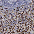 Immunohistochemical staining of human spleen shows strong granular cytoplasmic positivity in cells in red pulp.