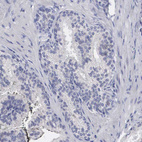 Immunohistochemical staining of human prostate shows no positivity in glandular cells as expected.