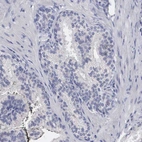 Immunohistochemical staining of human prostate shows no positivity in glandular cells as expected.