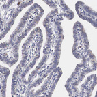 Immunohistochemical staining of human Fallopian tube shows shows no positivity in glandular cells as expected.
