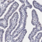 Immunohistochemical staining of human Fallopian tube shows shows no positivity in glandular cells as expected.
