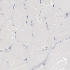Immunohistochemical staining of human skeletal muscle shows shows no positivity in myocytes as expected.