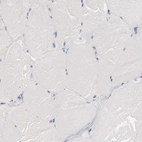Immunohistochemical staining of human skeletal muscle shows shows no positivity in myocytes as expected.