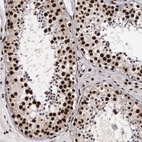 Anti-PABPN1 Antibody