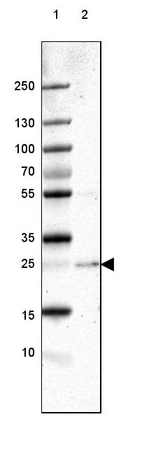 Lane 1: Marker [kDa] 250, 130, 100, 70, 55, 35, 25, 15, 10_br/_Lane 2: Human Cerebral Cortex tissue