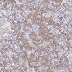 Anti-ARFGAP3 Antibody