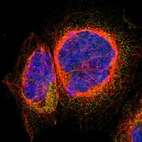 Immunofluorescent staining of human cell line A-431 shows localization to cytosol.