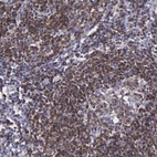 Anti-MICAL3 Antibody