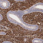 Anti-LGALS1 Antibody