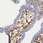 Immunohistochemical staining of human placenta shows moderate cytoplasmic positivity in decidual cells.