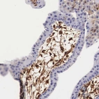 Immunohistochemical staining of human placenta shows moderate cytoplasmic positivity in decidual cells.