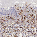 Immunohistochemical staining of human skin shows moderate cytoplasmic positivity in dermal cells.