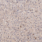 Anti-LGALS1 Antibody