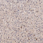 Immunohistochemical staining of human liver shows moderate cytoplasmic positivity in a subset of hepatocytes.