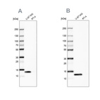 Western blot analysis using Anti-LGALS1 antibody HPA000646 (A) shows similar pattern to independent antibody HPA000687 (B).