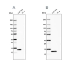 Western blot analysis using Anti-LGALS1 antibody HPA000646 (A) shows similar pattern to independent antibody HPA000687 (B).