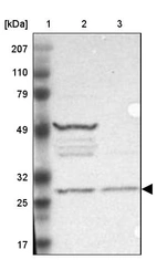 Lane 1: Marker [kDa] 207, 110, 79, 49, 32, 25, 17_br/_Lane 2: Human cell line RT-4_br/_Lane 3: Human cell line EFO-21