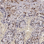 Immunohistochemical staining of human placenta shows strong granular cytoplasmic positivity in trophoblastic cells.