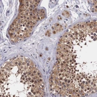 Immunohistochemical staining of human testis shows strong granular cytoplasmic positivity in cells in seminiferous ducts.