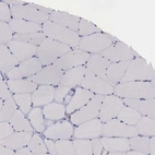 Immunohistochemical staining of human skeletal muscle shows no positivity in myocytes as expected.