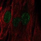 Anti-C22orf23 Antibody