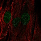 Anti-C22orf23 Antibody