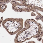 Immunohistochemical staining of human placenta shows moderate cytoplasmic positivity in trophoblastic cells.