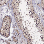 Anti-VASH1 Antibody