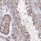 Immunohistochemical staining of human testis shows moderate cytoplasmic-nuclear positivity in cells in seminiferous ducts and Leydig cells.