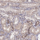Immunohistochemical staining of human kidney shows weak cytoplasmic positivity in cells in tubules.