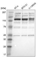 Western blot analysis in human cell line RT-4, human cell line EFO-21 and human cell line U-138MG.
