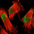 Anti-ACIN1 Antibody