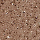 Anti-TECPR2 Antibody