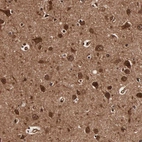 Anti-TECPR2 Antibody