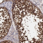 Immunohistochemical staining of human testis shows strong cytoplasmic positivity in cells in seminiferous ducts.