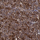 Immunohistochemical staining of human pancreas shows strong cytoplasmic positivity in exocrine glandular cells.