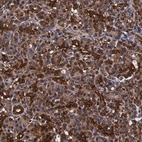 Immunohistochemical staining of human pancreas shows strong cytoplasmic positivity in exocrine glandular cells.