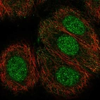 Immunofluorescent staining of human cell line MCF7 shows localization to nucleus.