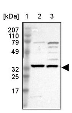 Lane 1: Marker [kDa] 207, 110, 79, 49, 32, 25, 17_br/_Lane 2: Human cell line RT-4_br/_Lane 3: Human cell line EFO-21