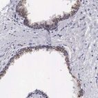 Immunohistochemical staining of human prostate shows strong cytoplasm granular positivity in glandular cells.