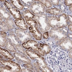 Immunohistochemical staining of human kidney shows strong cytoplasm granular positivity in cells in tubules.