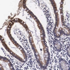 Immunohistochemical staining of human gastrointestinal shows moderate cytoplasm granular positivity in glandular cells.