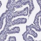 Immunohistochemical staining of human fallopian tube shows no positivity in glandular cells as expected.
