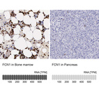 Anti-FCN1 Antibody