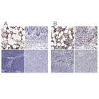 Immunohistochemical staining of human bone marrow, gastrointestinal, lymphoid tissues and pancreas using Anti-FCN1 antibody HPA000685 (A) shows similar protein distribution across tissues to independent antibody HPA001295 (B).