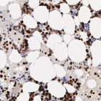 Immunohistochemical staining of human bone marrow shows strong cytoplasmic positivity in hematopoietic cells.