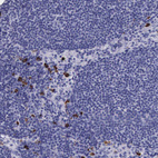 Anti-FCN1 Antibody