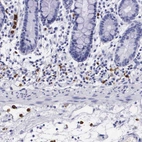 Immunohistochemical staining of human small intestine shows strong cytoplasmic positivity in lymphoid cells.