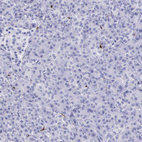 Anti-FCN1 Antibody